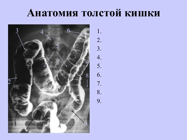 Анатомия толстой кишки 1. 2. 3. 4. 5. 6. 7. 8. 9.