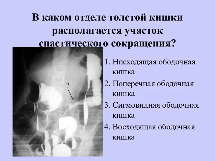 В каком отделе толстой кишки располагается участок спастического сокращения? 1. Нисходящая ободочная