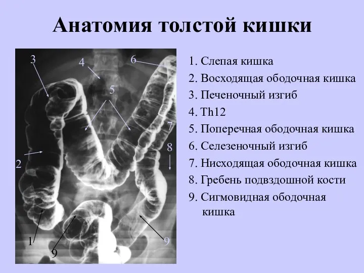 Анатомия толстой кишки 1. Слепая кишка 2. Восходящая ободочная кишка 3. Печеночный