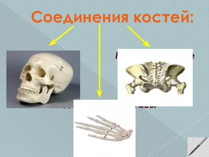 Соединения костей: Неподвижные Подвижные - суставы Малоподвижные
