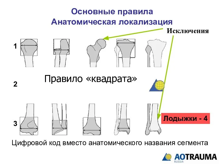 Основные правила Анатомическая локализация Исключения Лодыжки - 4 1 2 3 Правило