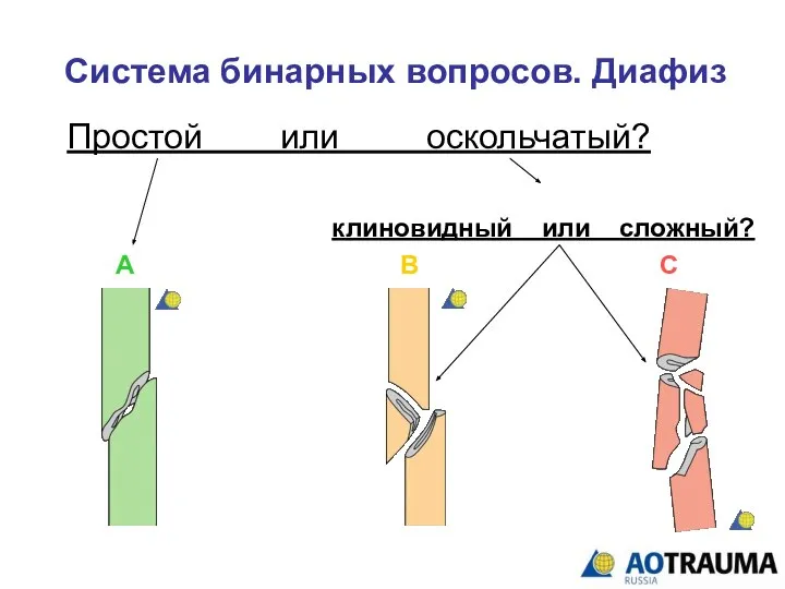 Система бинарных вопросов. Диафиз Простой или оскольчатый? А В С клиновидный или сложный?