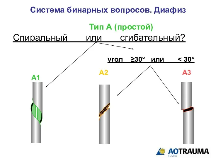 Система бинарных вопросов. Диафиз Тип А (простой) Спиральный или сгибательный? А1 А2 А3 угол ≥30° или