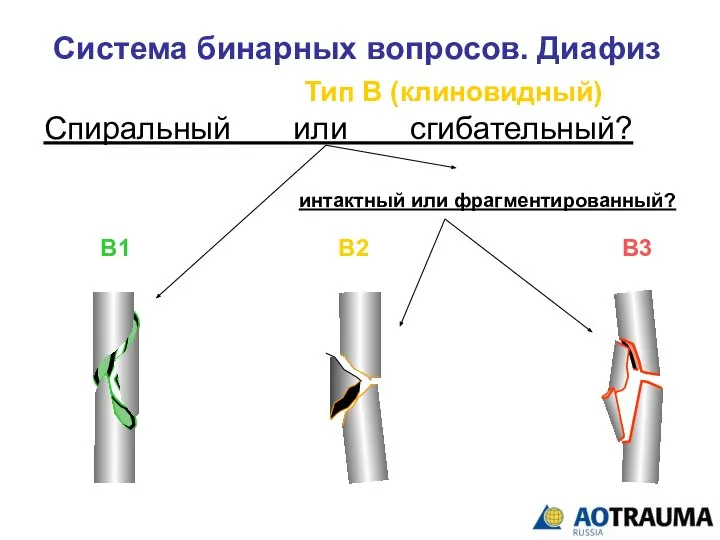 Система бинарных вопросов. Диафиз Тип В (клиновидный) Спиральный или сгибательный? В1 В2 В3 интактный или фрагментированный?