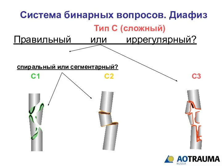 Система бинарных вопросов. Диафиз Тип С (сложный) Правильный или иррегулярный? С1 С2 С3 спиральный или сегментарный?