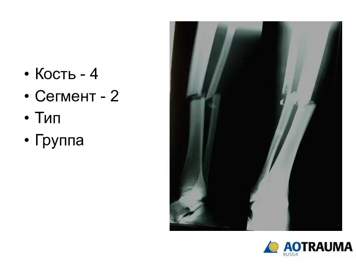 Кость - 4 Сегмент - 2 Тип Группа