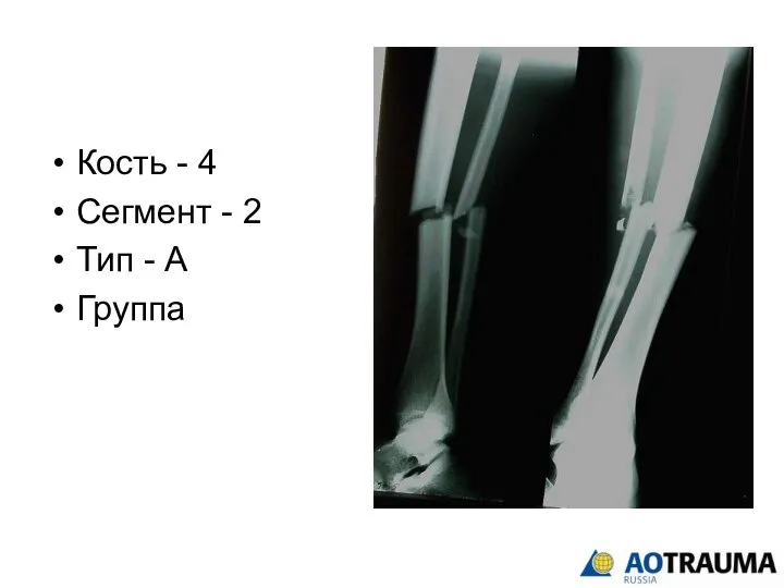 Кость - 4 Сегмент - 2 Тип - А Группа