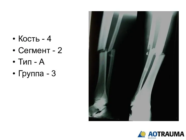 Кость - 4 Сегмент - 2 Тип - А Группа - 3