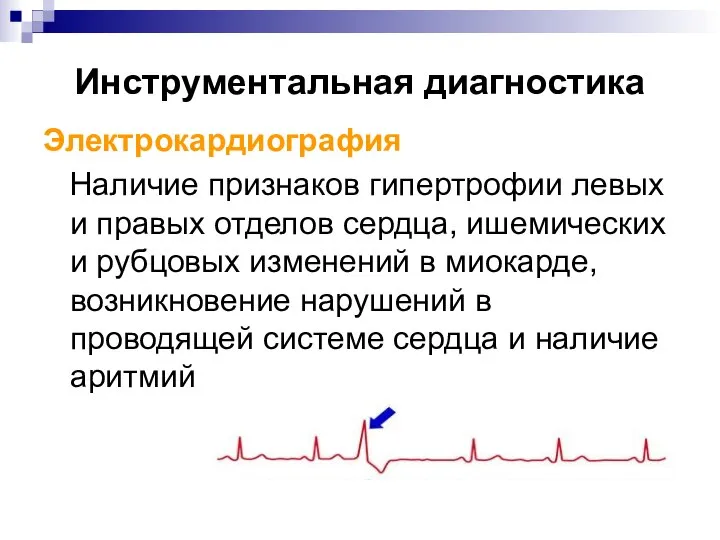 Инструментальная диагностика Электрокардиография Наличие признаков гипертрофии левых и правых отделов сердца, ишемических