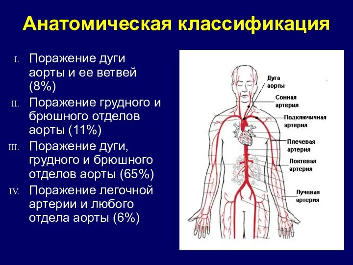 Анатомическая классификация Поражение дуги аорты и ее ветвей (8%) Поражение грудного и