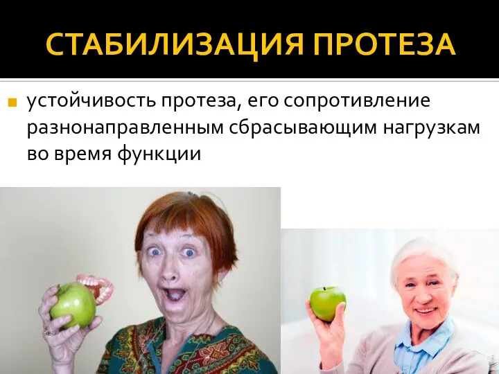 СТАБИЛИЗАЦИЯ ПРОТЕЗА устойчивость протеза, его сопротивление разнонаправленным сбрасывающим нагрузкам во время функции