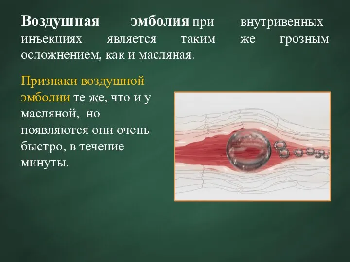 Воздушная эмболия при внутривенных инъекциях является таким же грозным осложнением, как и