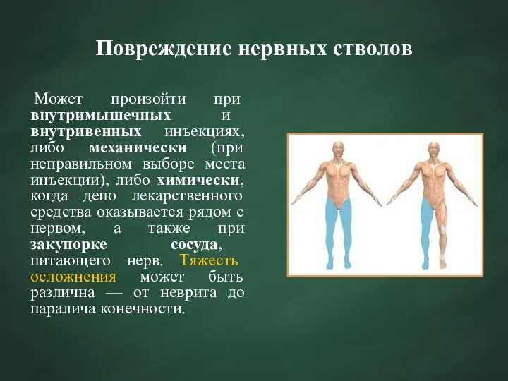 Повреждение нервных стволов Может произойти при внутримышечных и внутривенных инъекциях, либо механически