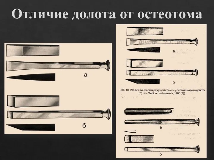 Отличие долота от остеотома