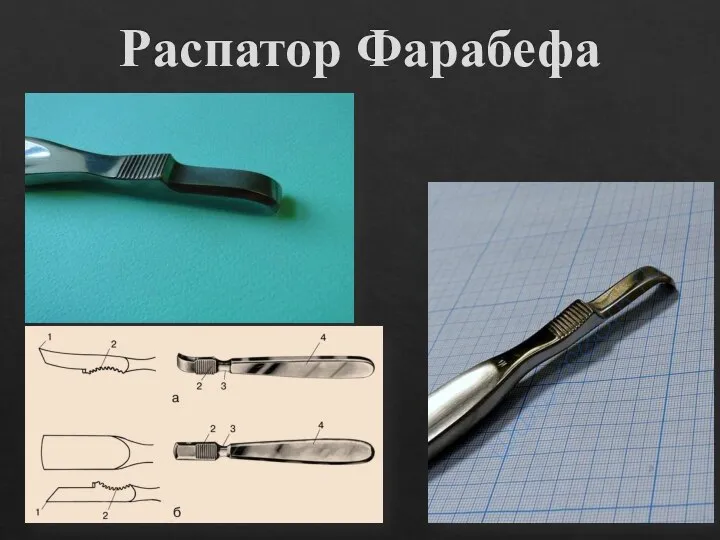 Распатор Фарабефа