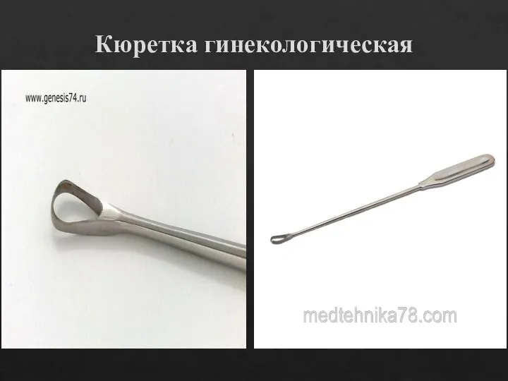 Кюретка гинекологическая