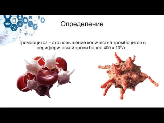 Определение Тромбоцитоз – это повышение количества тромбоцитов в периферической крови более 400 х 109/л.