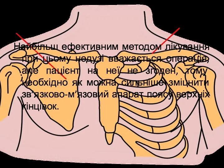 Найбільш ефективним методом лікування при цьому недузі вважається операція, але пацієнт на