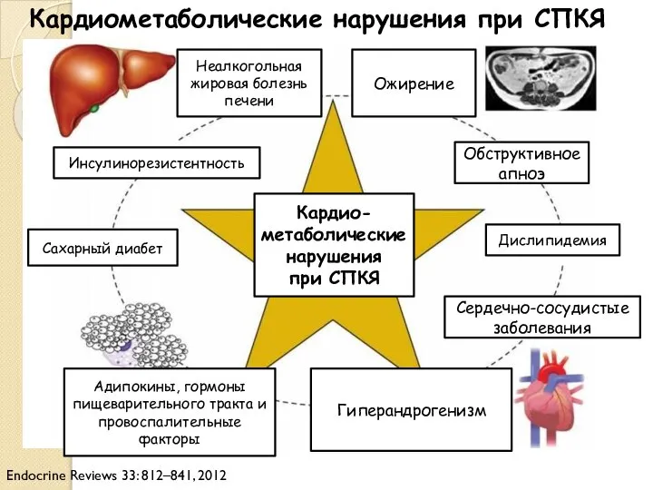 Ожирение Дислипидемия Сердечно-сосудистые заболевания Гиперандрогенизм Сахарный диабет Инсулинорезистентность Обструктивное апноэ Неалкогольная жировая