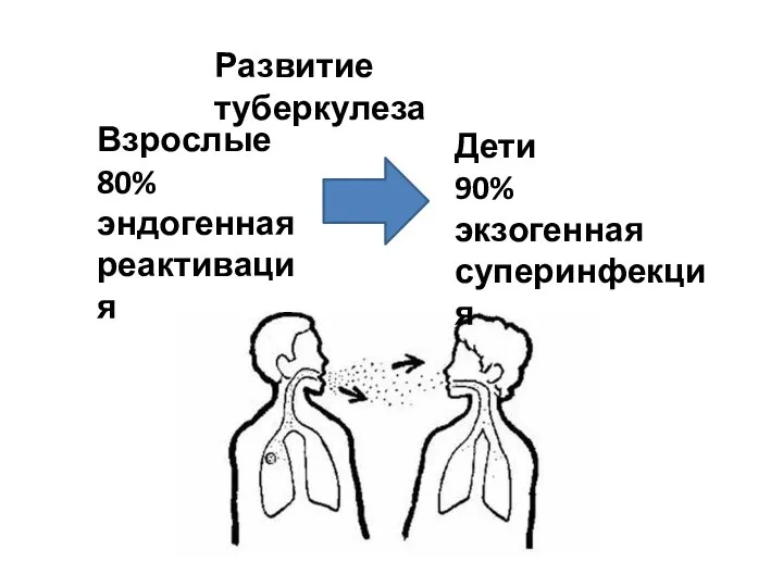 Развитие туберкулеза Взрослые 80% эндогенная реактивация Дети 90% экзогенная суперинфекция