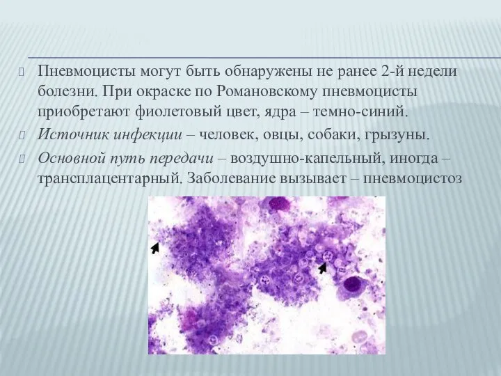 Пневмоцисты могут быть обнаружены не ранее 2-й недели болезни. При окраске по