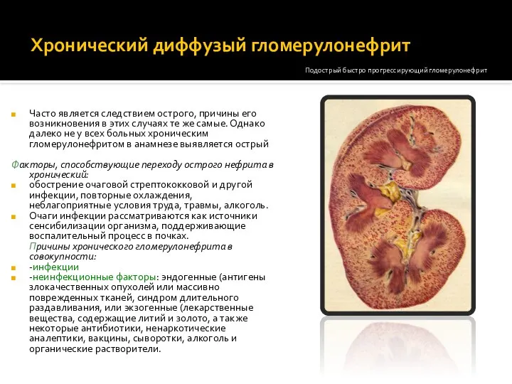 Хронический диффузый гломерулонефрит Часто является следствием острого, причины его возникновения в этих