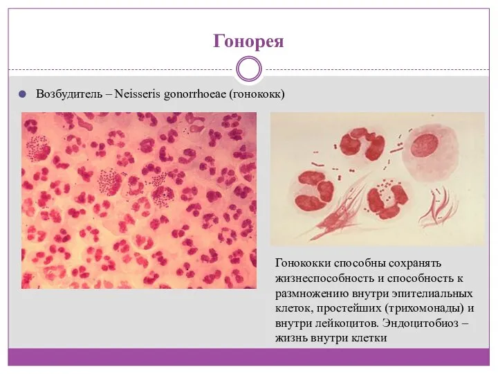 Гонорея Возбудитель – Neisseris gonorrhoeae (гонококк) Гонококки способны сохранять жизнеспособность и способность