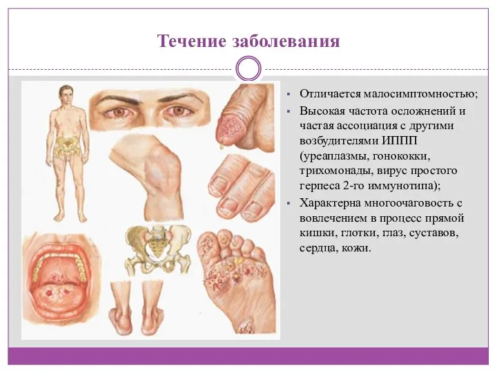 Течение заболевания Отличается малосимптомностью; Высокая частота осложнений и частая ассоциация с другими