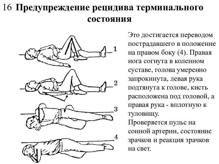 Предупреждение рецидива терминального состояния Это достигается переводом пострадавшего в положение на правом