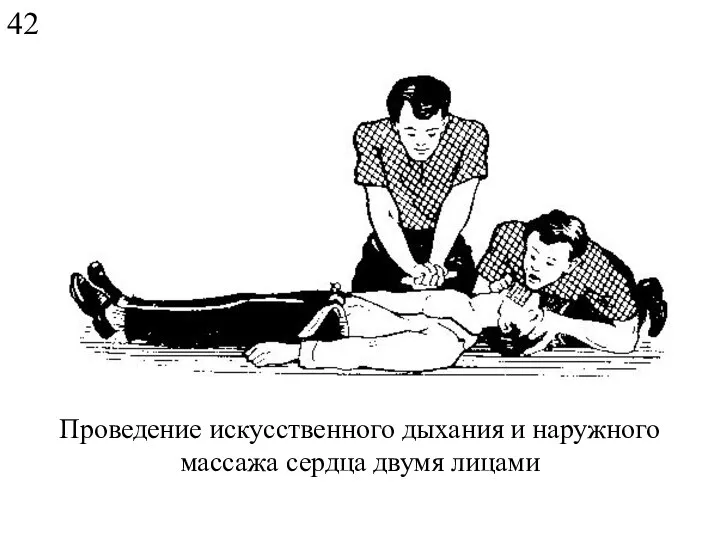 Проведение искусственного дыхания и наружного массажа сердца двумя лицами 42