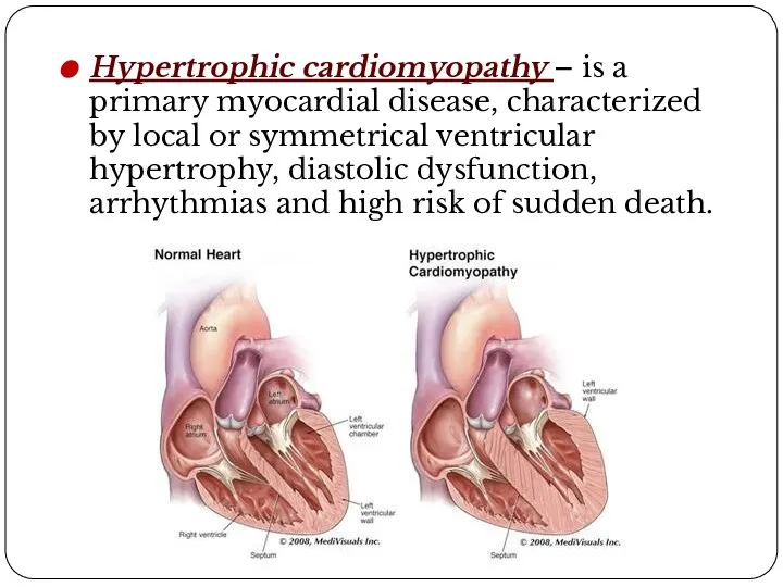 Hypertrophic cardiomyopathy – is a primary myocardial disease, characterized by local or