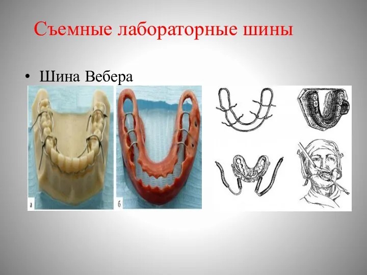 Съемные лабораторные шины Шина Вебера