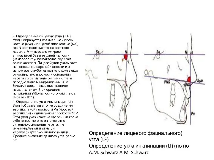 3. Определение лицевого угла ( L F ) . Угол F образуется