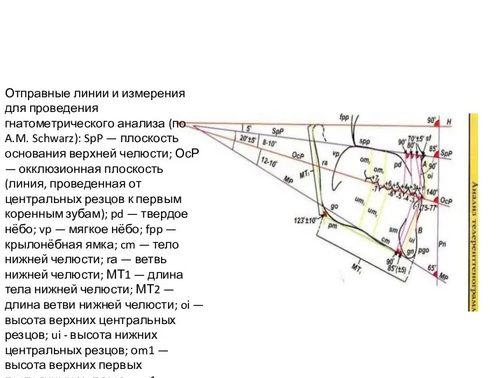 Отправные линии и измерения для проведения гнатометрического анализа (по A.M. Schwarz): SpP