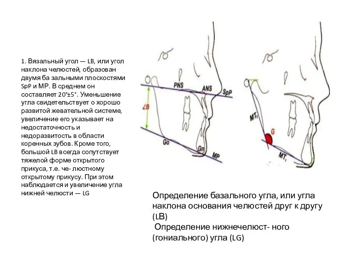 1. Вязальный угол — LB, или угол наклона челюстей, образован двумя ба­