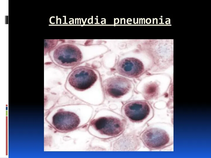 Chlamydia pneumonia