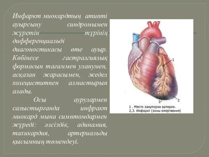 Инфаркт миокардтың атипті ауырсыну синдромымен жүретін түрінің дифференциальді диагоностикасы өте ауыр. Көбінесе