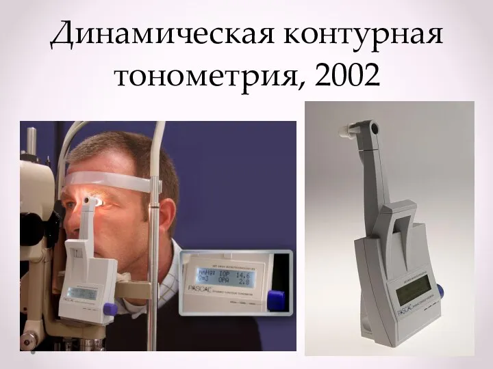 Динамическая контурная тонометрия, 2002