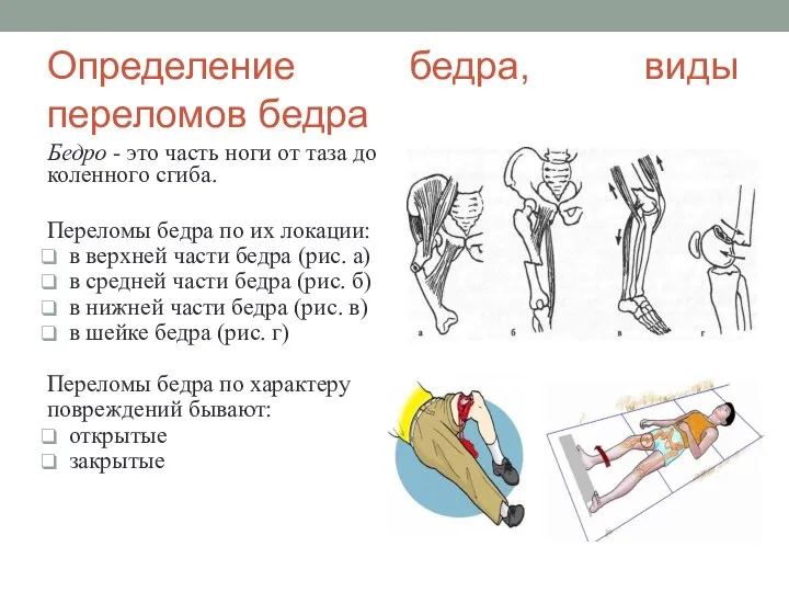 Определение бедра, виды переломов бедра Бедро - это часть ноги от таза