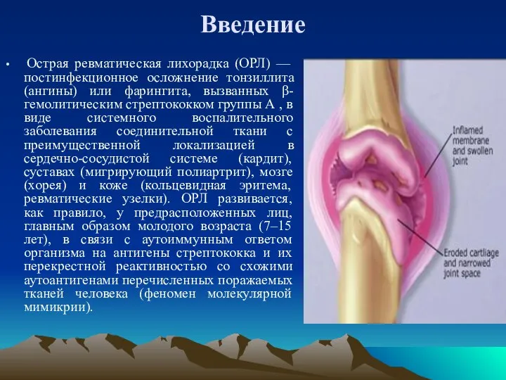 Введение Острая ревматическая лихорадка (ОРЛ) — постинфекционное осложнение тонзиллита (ангины) или фарингита,