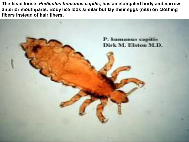The head louse, Pediculus humanus capitis, has an elongated body and narrow