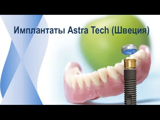 Имплантаты Astra Tech (Швеция)