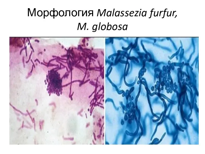 Морфология Malassezia furfur, M. globosa