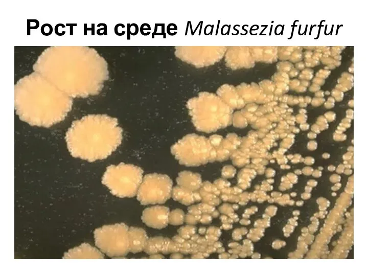 Рост на среде Malassezia furfur