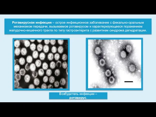 Ротавирусная инфекция – острое инфекционное заболевание с фекально-оральным механизмом передачи, вызываемое ротавирусом