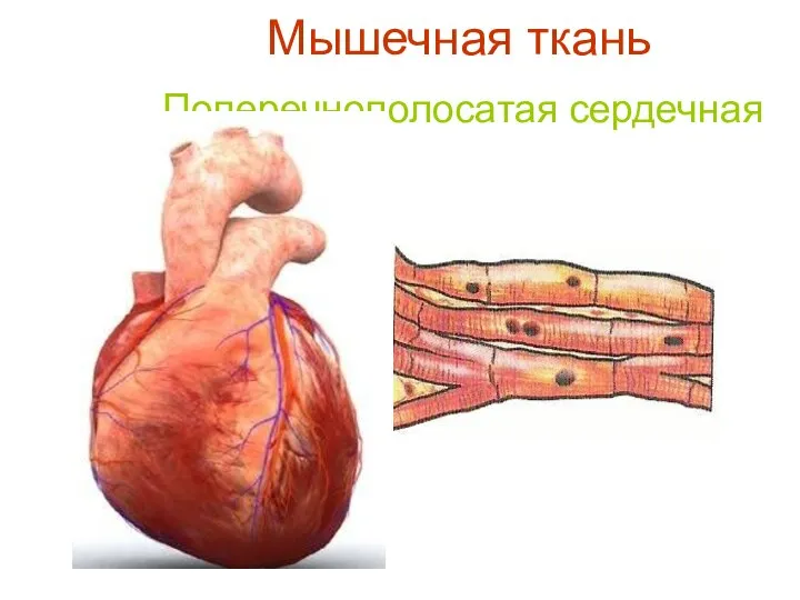 Мышечная ткань Поперечнополосатая сердечная