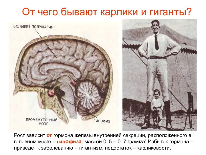 От чего бывают карлики и гиганты? Рост зависит от гормона железы внутренней