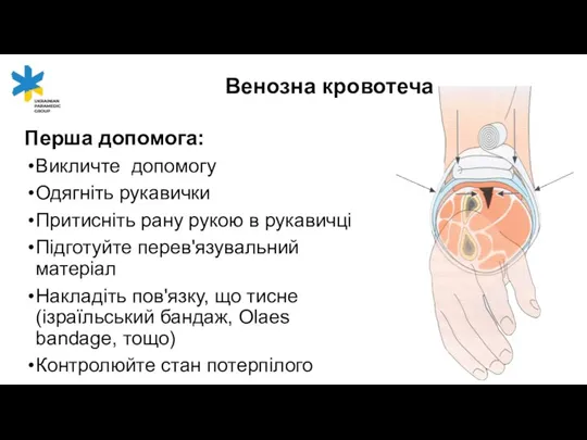 Перша допомога: Викличте допомогу Одягніть рукавички Притисніть рану рукою в рукавичці Підготуйте