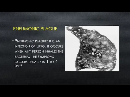 PNEUMONIC PLAGUE Pneumonic plague: it is an infection of lung, it occurs
