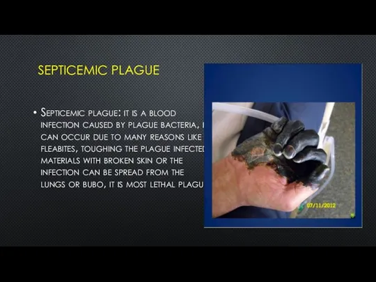 SEPTICEMIC PLAGUE Septicemic plague: it is a blood infection caused by plague